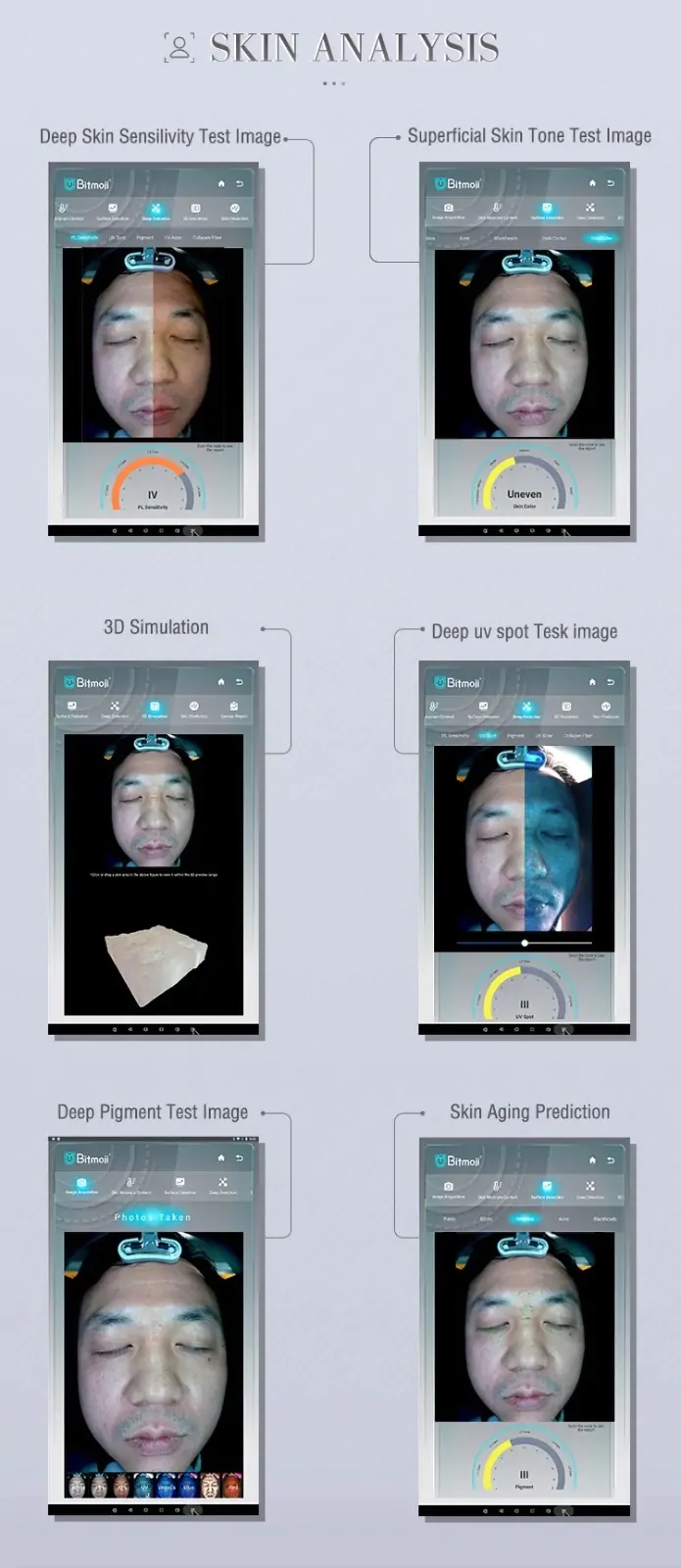 Artificial Intelligence Skin Analyzer - Image 10